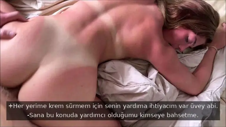 plajda uyuyakaldigi icin gunes yanigi olan surtugun rahatlatan sey uvey abisinin dolleri.jpg